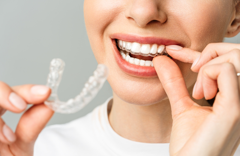 Invisalign et ClearCorrect aligneurs | Cabinet Orthodontie du Souverain
